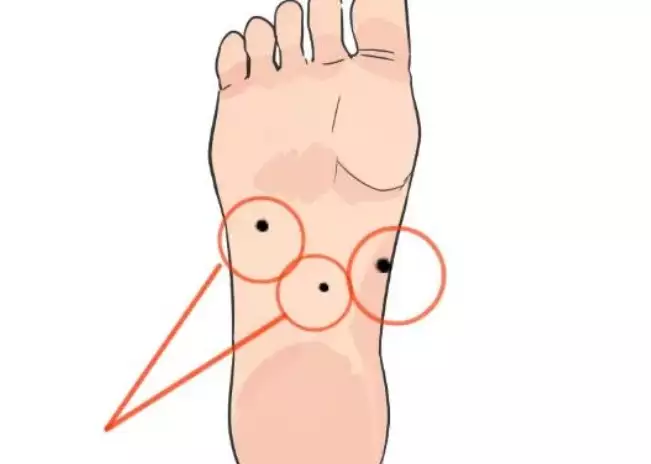 女人脚底有痣代表什么?详解吉凶与运势.jpg 女人脚底有痣代表什么?详解吉凶与运势.jpg
