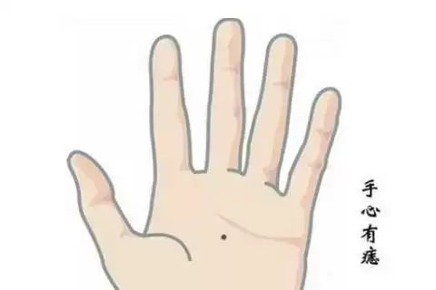 手掌心有痣说明什么？关于命运与性格的多种解读.jpg