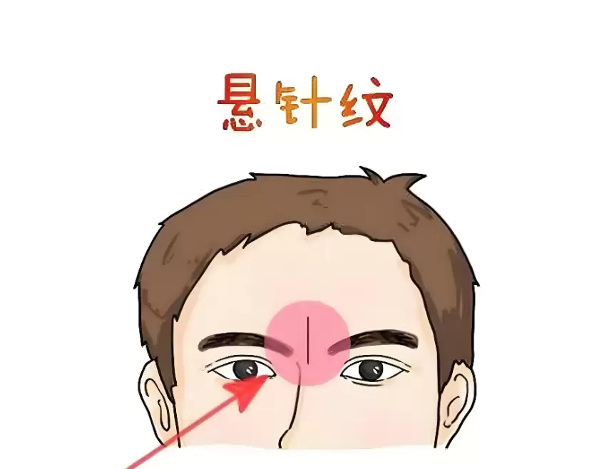 除了悬针纹，眉间这3种竖纹（双雀纹 / 八字纹 / 川字纹）也有讲究.png