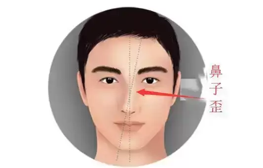 鼻子歪的人面相好不好？一文说清寓意.jpg