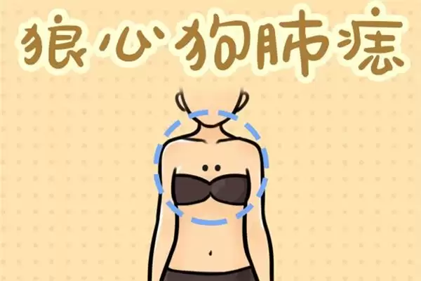 有狼心狗肺痣之人是否可靠.jpg 有狼心狗肺痣之人是否可靠.jpg